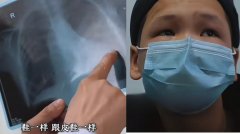 男孩累到提不起书包 送医惊见心脏畸形如